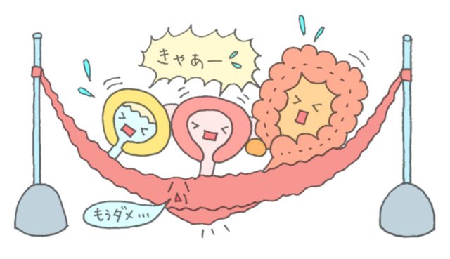 ゆるんだ骨盤底筋のイラスト