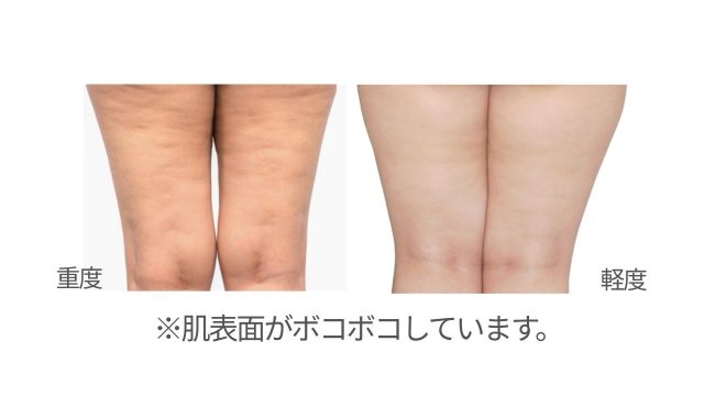 鏡で太ももの裏側をチェックする女性